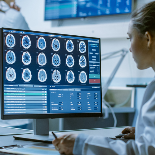 Eine Ärztin betrachtet Röntgenbilder am Monitor