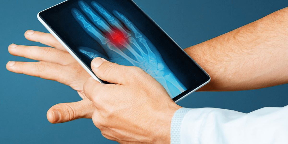 Das Bild zeigt eine Nahaufnahme einer Person, die ein Tablet hält, auf dem eine Röntgenaufnahme einer Hand zu sehen ist. Die Hand auf dem Tablet weist einen roten Fleck auf, der eine Verletzung oder Entzündung anzeigt. Die Person hält ihre eigene, gesunde Hand über dem Tablet, was einen Vergleich zwischen dem Röntgenbild und der realen Hand suggeriert. 